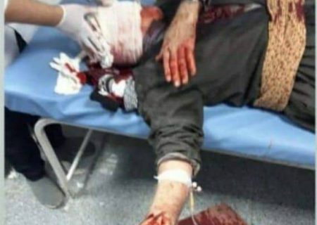 حمله گرگ ها در جوانرود ۳ شهروند را مجروح کرد